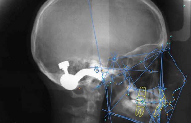 Artificial Intelligence Orthodontics